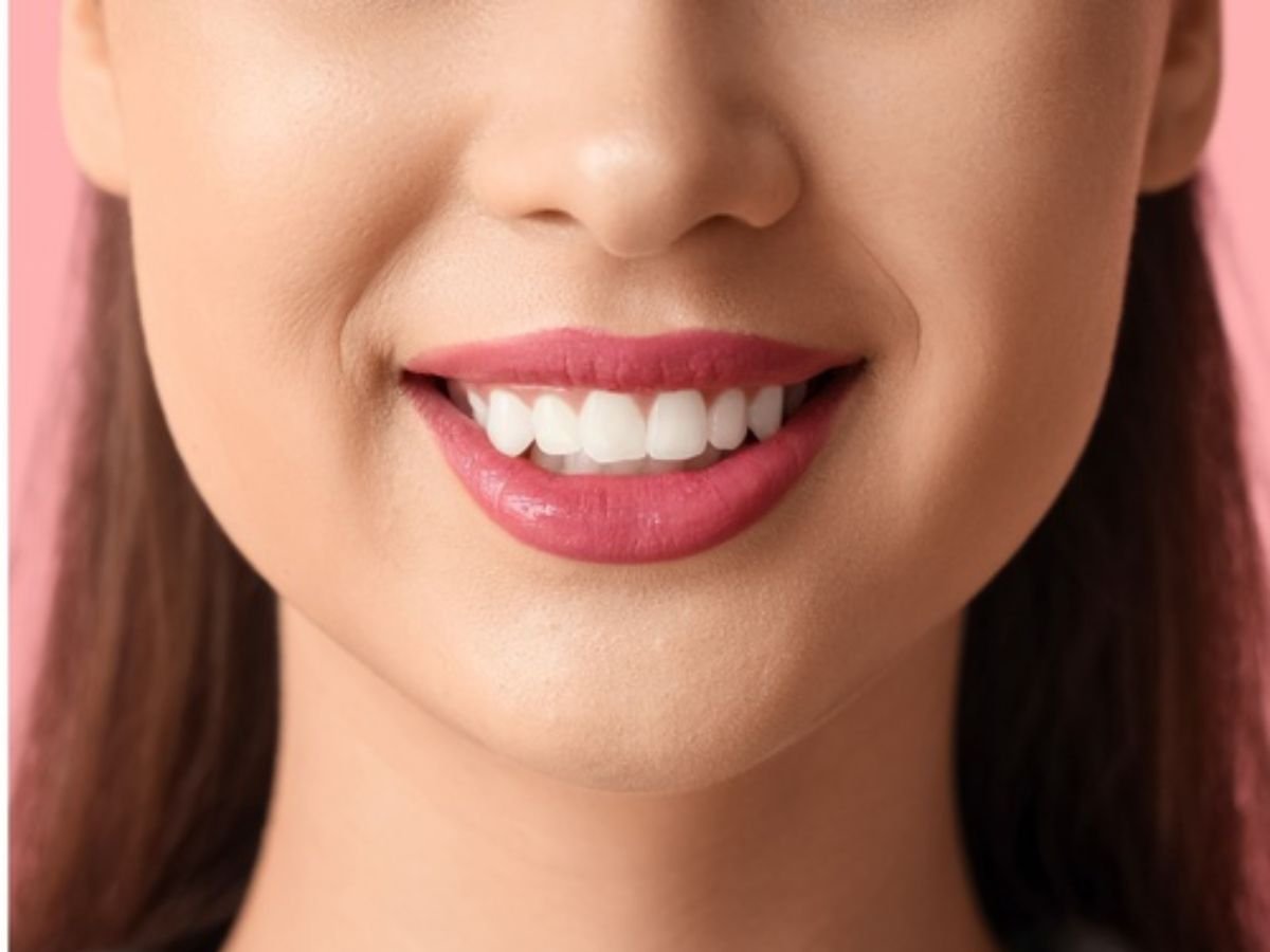 After whitening