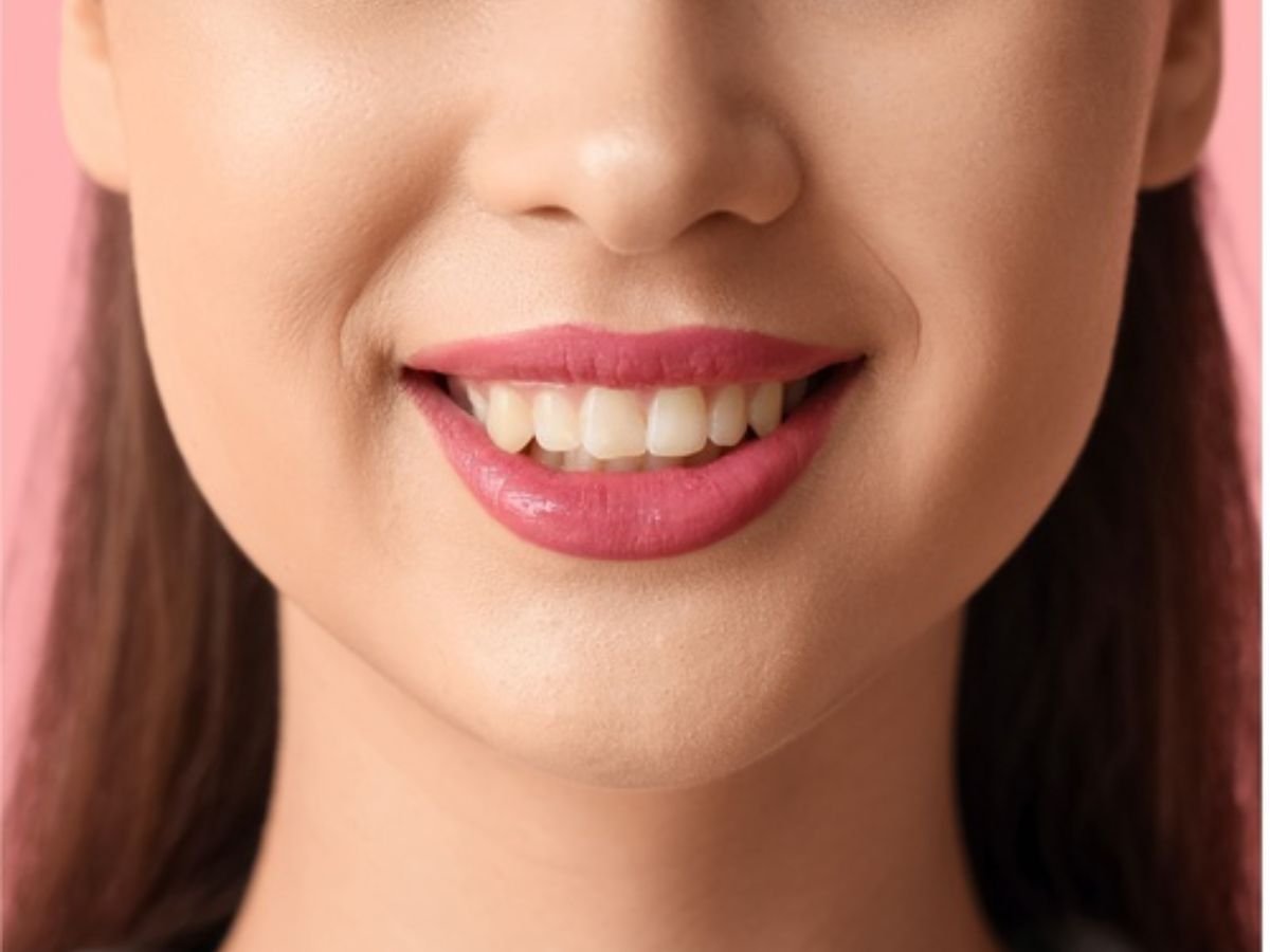 Before whitening