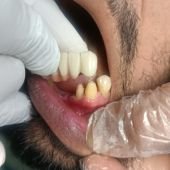 Dental chair