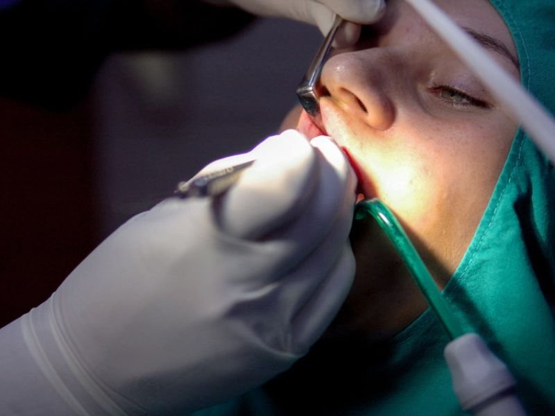 Apicoectomy procedure