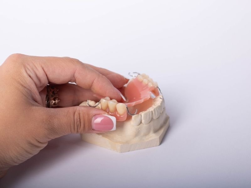 Dental bridges