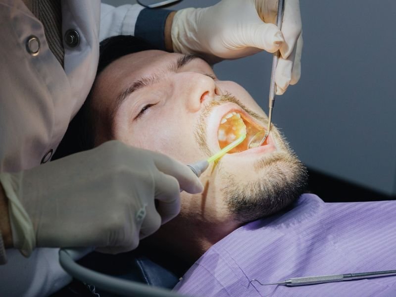 Fluoride treatment