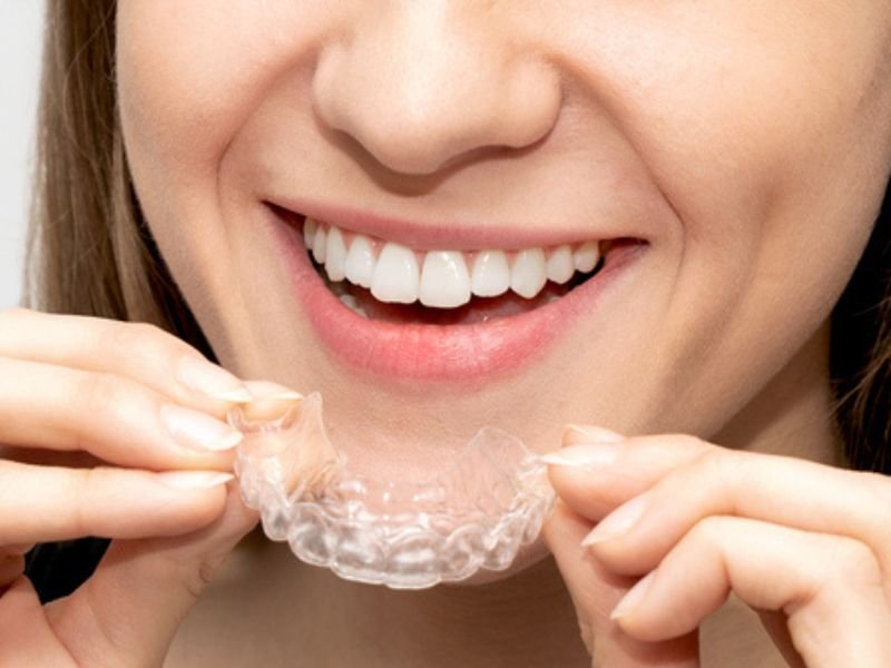 Invisalign treatment