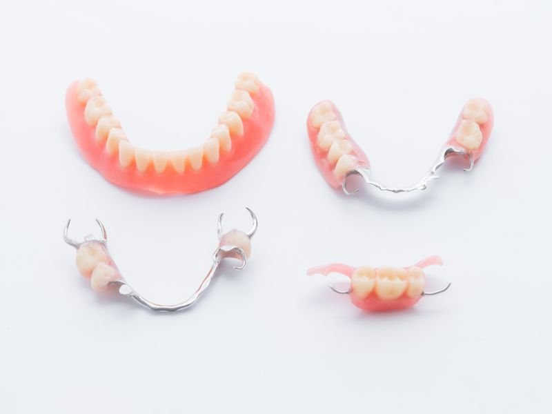 Partial dentures