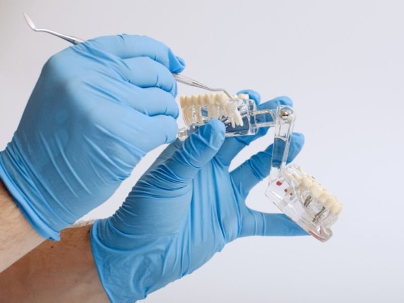 Wisdom tooth extraction